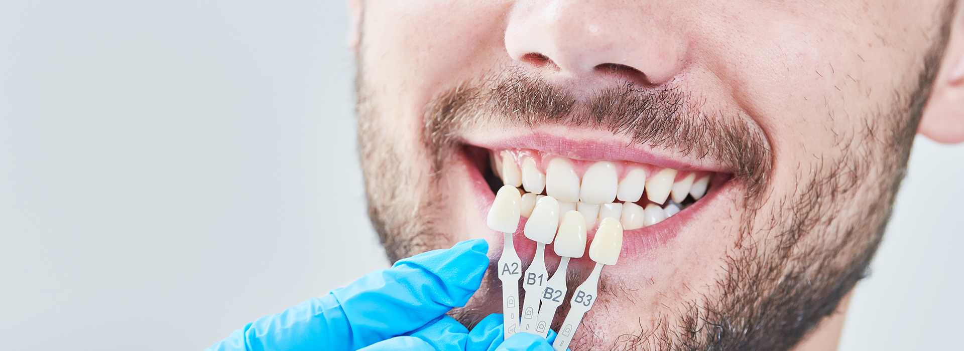 Smile Philosophy Dental Care | Implant Restorations, Ceramic Crowns and Preventative Program